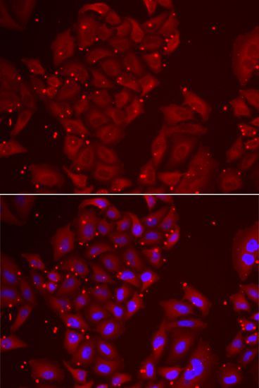 Immunofluorescence - TPP2 antibody (144-06421)