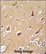 IHC-P