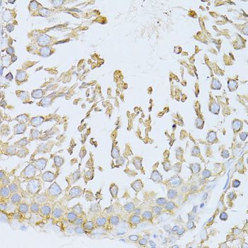 Immunohistochemistry - HSPA5 Polyclonal Antibody (144-011366)