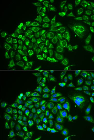 Immunofluorescence - RCVRN antibody (144-06404)