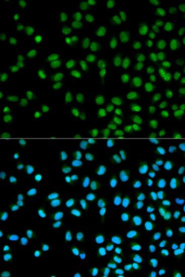 Immunofluorescence - CST8 antibody (144-01224)