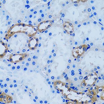 Immunohistochemistry - IMPA1 antibody (144-06381)