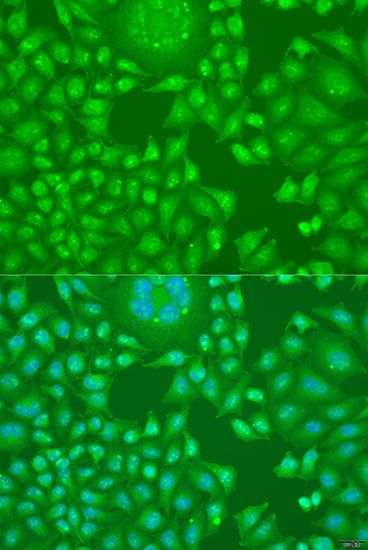 Immunofluorescence - CCND2 antibody (144-01773)