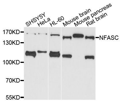 Western blot - NFASC antibody (144-03053)