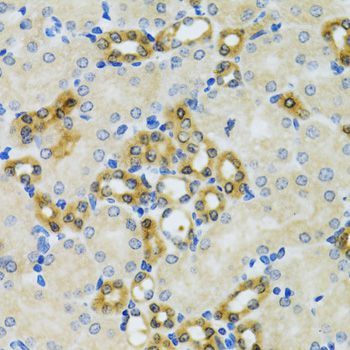 Immunohistochemistry - PHPT1 antibody (144-01127)