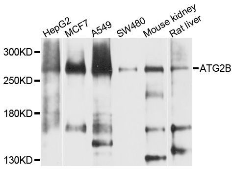 Western blot - ATG2B Polyclonal Antibody (144-08498)
