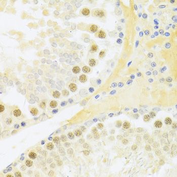 Immunohistochemistry - RFC4 Polyclonal Antibody (144-05485)
