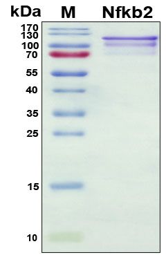 SDS-PAGE