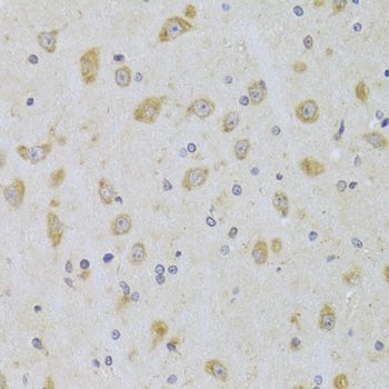 Immunohistochemistry - MAP2K5 Polyclonal Antibody (144-06953)