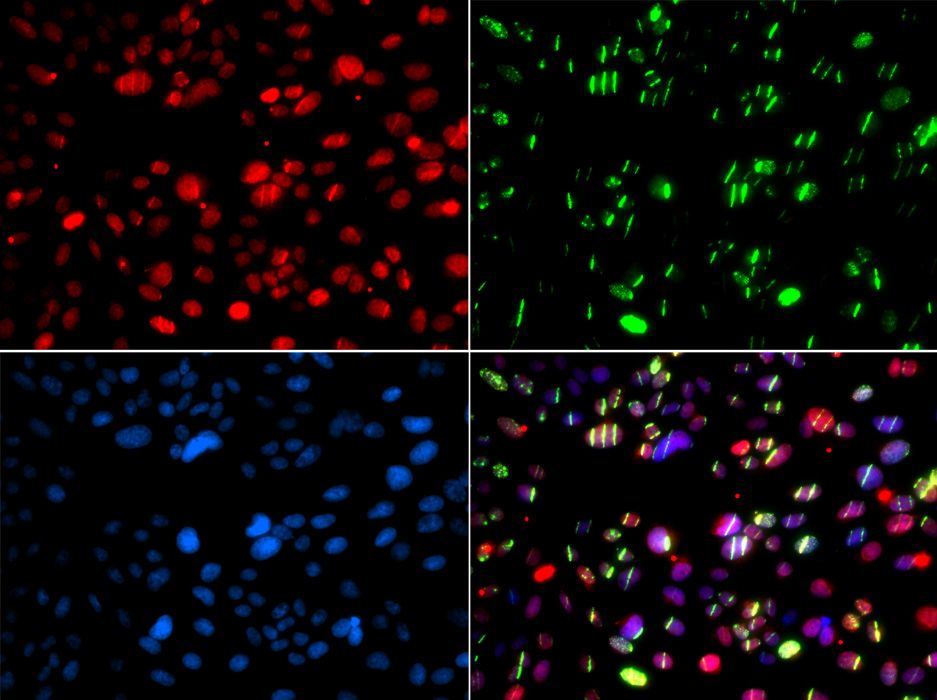 Immunofluorescence - PNKP antibody (144-06693)