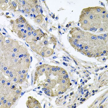 Immunohistochemistry - NDUFA6 antibody (144-09831)