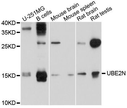 Western blot - UBE2N Polyclonal Antibody (144-010543)