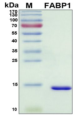 SDS-PAGE
