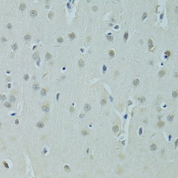Immunohistochemistry - ZNF346 antibody (144-07507)