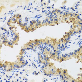 Immunohistochemistry - UVRAG antibody (144-08462)