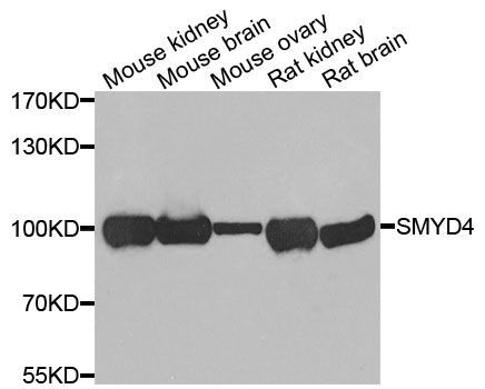 Western blot - SMYD4 Polyclonal Antibody (144-07310)
