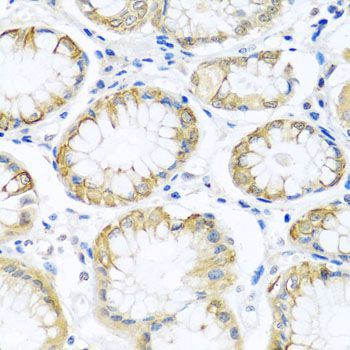 Immunohistochemistry - PCDHA12 antibody (144-08501)