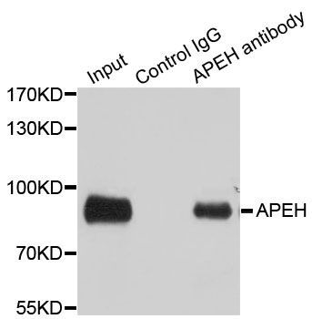 Immunoprecipitation - 3ug APEH antibody (144-05893)