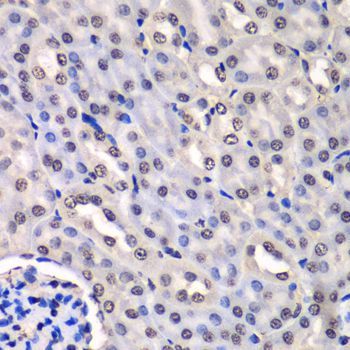 Immunohistochemistry - HNRNPM Polyclonal Antibody (144-06937)