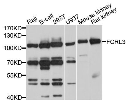 Western blot - FCRL3 Polyclonal Antibody (144-10451)