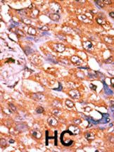 IHC-P