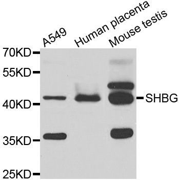 Western blot - SHBG antibody (144-07450)
