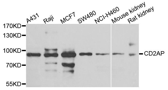 Western blot - CD2AP antibody (144-07788)