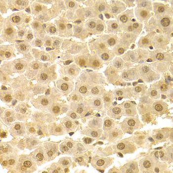 Immunohistochemistry - CDK4 Polyclonal Antibody (144-00366)