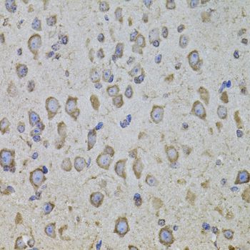 Immunohistochemistry - CRHR1 antibody (144-08409)