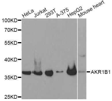 Western blot - AKR1B1 antibody (144-60529)