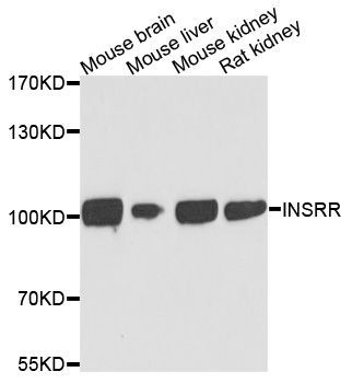 Western blot - INSRR Polyclonal Antibody (144-010083)