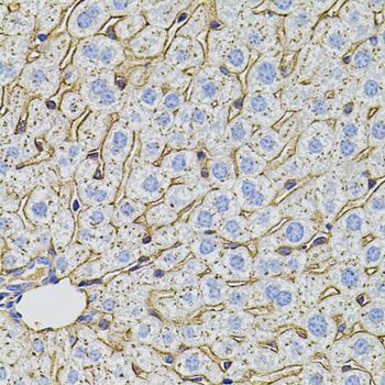 Immunohistochemistry - PCSK9 antibody (144-07860)