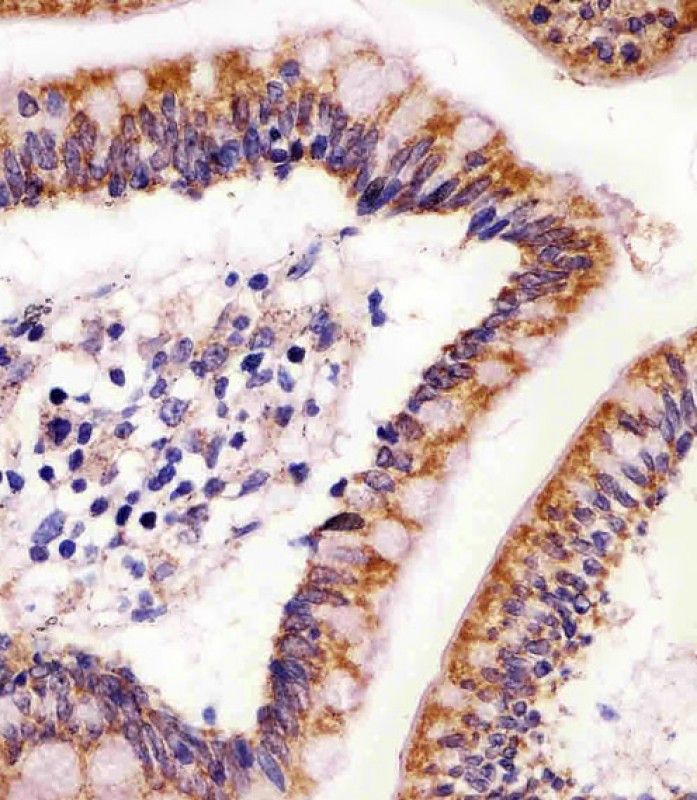 IHC-P