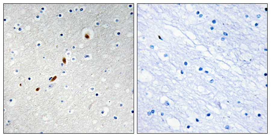 IHC