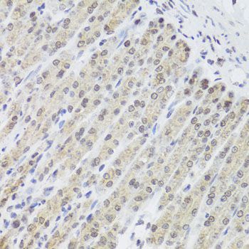 Immunohistochemistry - FANCL Polyclonal Antibody (144-06812)