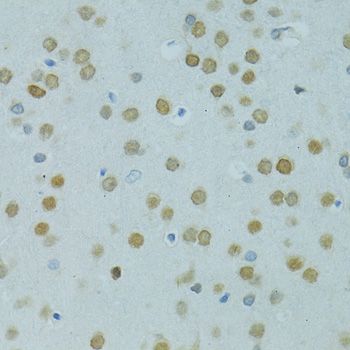 Immunohistochemistry - MUS81 antibody (144-06818)