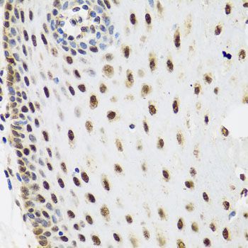Immunohistochemistry - SKIV2L2 antibody (144-05576)