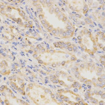Immunohistochemistry - GGA2 Antibody (144-01186)