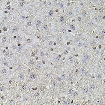 Immunohistochemistry - POT1 antibody (144-01491)