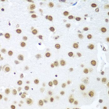 Immunohistochemistry - BCAS2 Polyclonal Antibody (144-04398)
