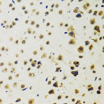 Immunohistochemistry - RUVBL2 antibody (144-12564)