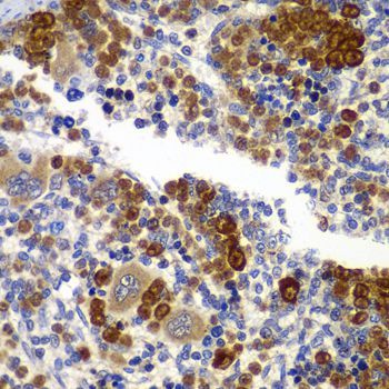 Immunohistochemistry - PRKAB1 antibody (144-07921)