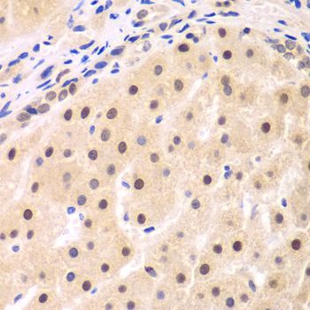 Immunohistochemistry - NFKBIB antibody (144-05777)