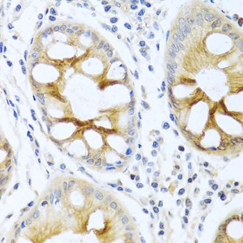 Immunohistochemistry - PRKCA Polyclonal Antibody (144-00267)
