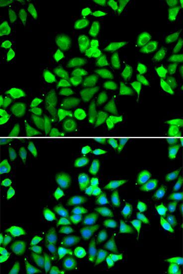 Immunofluorescence - CDC16 antibody (144-07197)