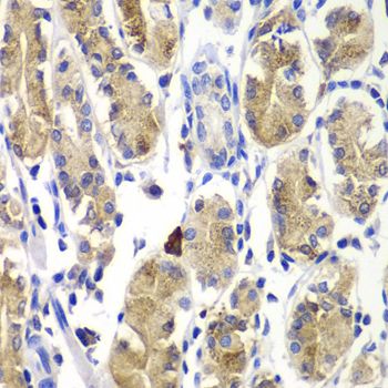 Immunohistochemistry - SHC1 antibody (144-07725)