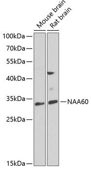 Western blot