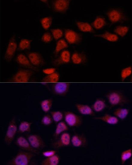 Immunofluorescence - YAP1 Polyclonal Antibody (144-01001)
