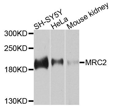 Western blot - MRC2 antibody (144-09858)