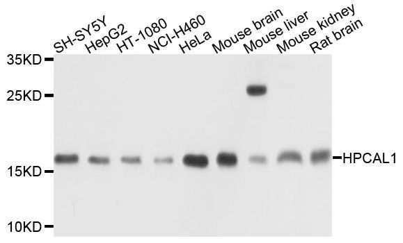 Western blot - HPCAL1 Polyclonal Antibody (144-010019)